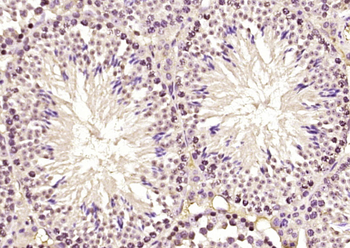 ELYS Rabbit Polyclonal Antibody