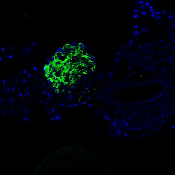 Proinsulin Rabbit Polyclonal Antibody