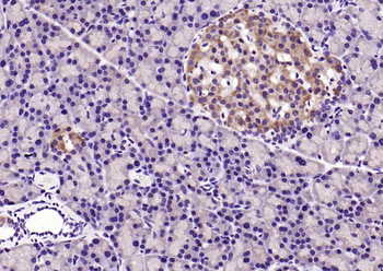IRS1 Rabbit Polyclonal Antibody
