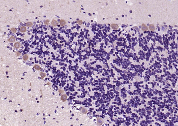 IRS1 Rabbit Polyclonal Antibody