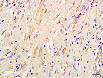 IRS3 Rabbit Polyclonal Antibody