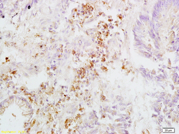 ITGB3 Rabbit Polyclonal Antibody