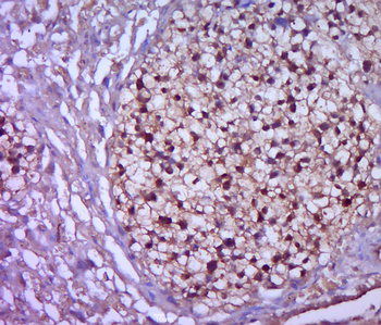 Phospho-KLF5 (Ser275) Rabbit Polyclonal Antibody