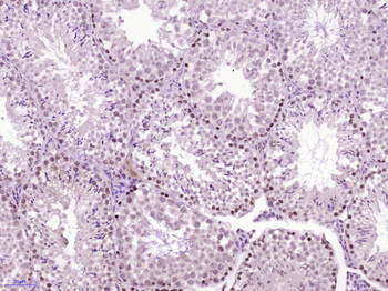 KLF6 Rabbit Polyclonal Antibody