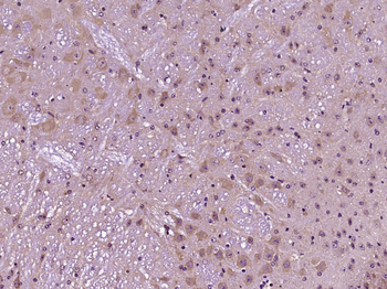 Kappa Opioid receptor Rabbit Polyclonal Antibody