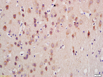 GnRHR Rabbit Polyclonal Antibody