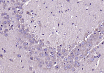 LIFR Rabbit Polyclonal Antibody