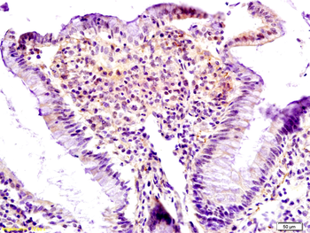 Lpin1 protein Rabbit Polyclonal Antibody
