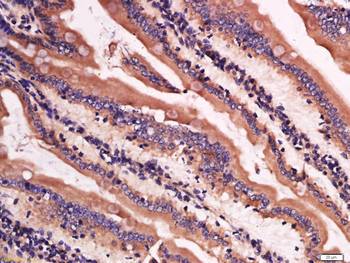 Lysozyme Rabbit Polyclonal Antibody