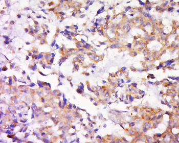 MEK1 + MEK2 Rabbit Polyclonal Antibody