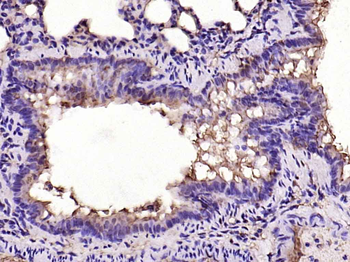 MCP1 Rabbit Polyclonal Antibody