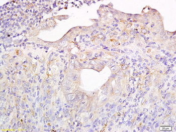 MT2A Rabbit Polyclonal Antibody