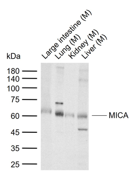 MICA Rabbit Polyclonal Antibody