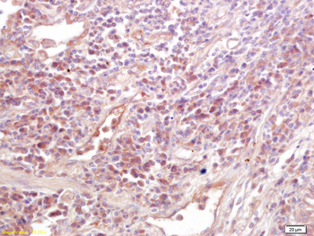 MICA Rabbit Polyclonal Antibody