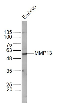 MMP13 Rabbit Polyclonal Antibody