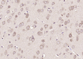 PAFAH1B2 Rabbit Polyclonal Antibody