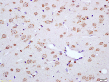 NF2 Rabbit Polyclonal Antibody