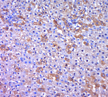 NIT2 Rabbit Polyclonal Antibody