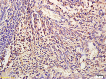NIT2 Rabbit Polyclonal Antibody