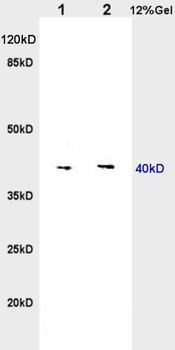 Nociceptin receptor Rabbit Polyclonal Antibody