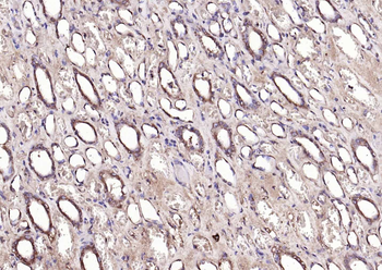 NADPH oxidase 4 Rabbit Polyclonal Antibody