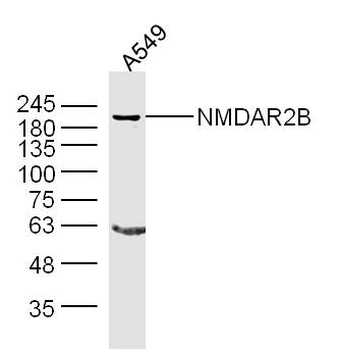 NMDAR2B Rabbit Polyclonal Antibody