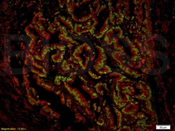 NRAS Rabbit Polyclonal Antibody