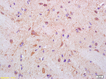 Neuropilin 1 Rabbit Polyclonal Antibody