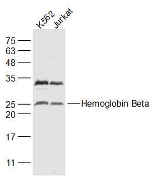 Hemoglobin Beta Rabbit Polyclonal Antibody