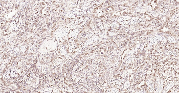 Nurr1 Rabbit Polyclonal Antibody