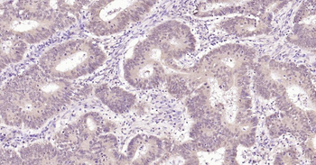 Nurr1 Rabbit Polyclonal Antibody