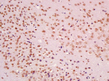 MEK3 Rabbit Polyclonal Antibody