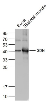 GDN antibody