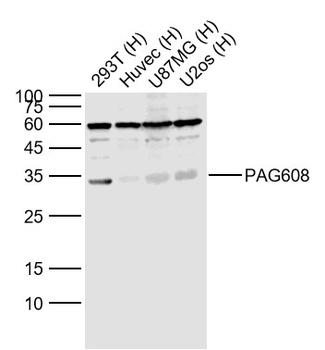 Wig-1 antibody