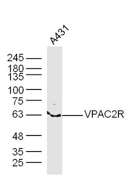 VIPR2 Rabbit Polyclonal Antibody