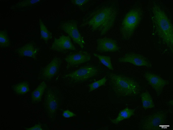 PAI1 Rabbit Polyclonal Antibody