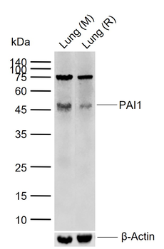 PAI1 Rabbit Polyclonal Antibody