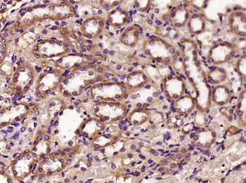 Phospho-PAK1 (Ser144) + PAK3 (Ser154) Rabbit Polyclonal Antibody
