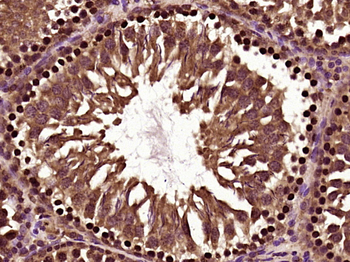 PAX3 Rabbit Polyclonal Antibody
