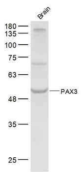 PAX3 Rabbit Polyclonal Antibody