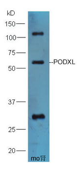 PODXL Rabbit Polyclonal Antibody