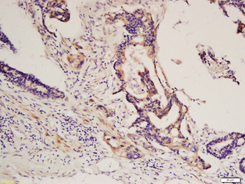 PDGFRA Rabbit Polyclonal Antibody