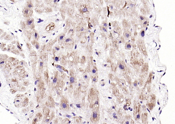 PDK4 Rabbit Polyclonal Antibody