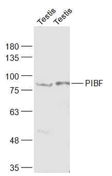 PIBF Rabbit Polyclonal Antibody