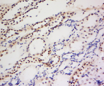 PIWIL1 Rabbit Polyclonal Antibody