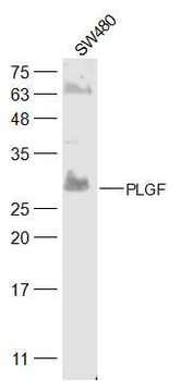 PLGF Rabbit Polyclonal Antibody