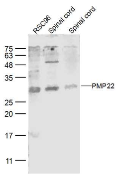 PMP22 Rabbit Polyclonal Antibody