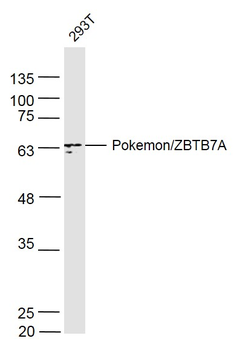 Pokemon/ZBTB7A Rabbit Polyclonal Antibody