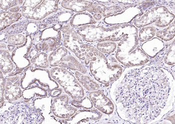 Profilin 1 Rabbit Polyclonal Antibody