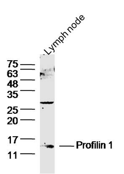 Profilin 1 Rabbit Polyclonal Antibody